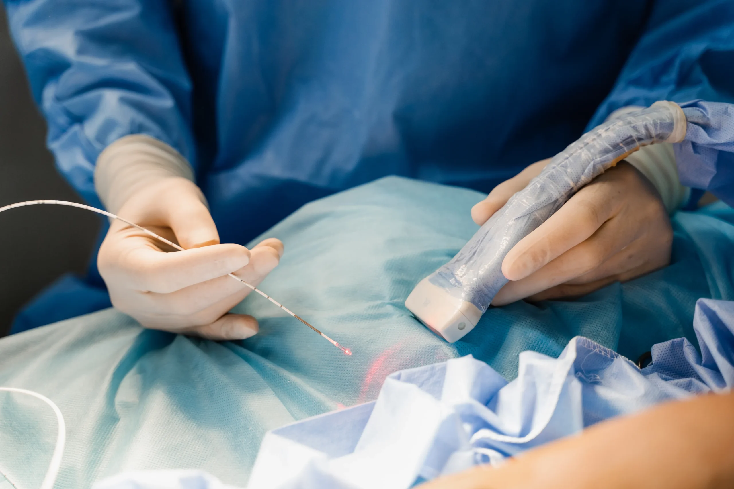 Esecuzione Laser Vascolare su paziente in ambulatorio