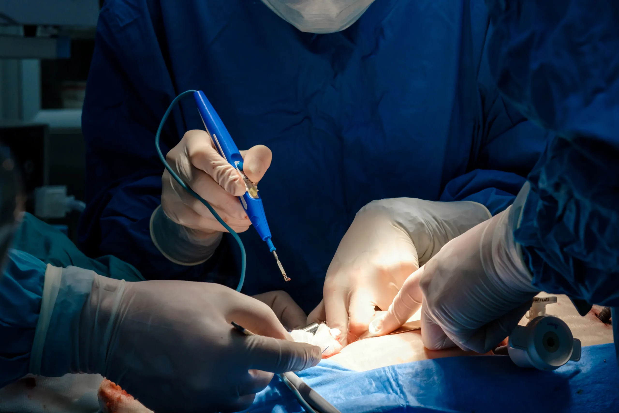 Dettaglio Operazione in sala operatoria - Plenio Roma